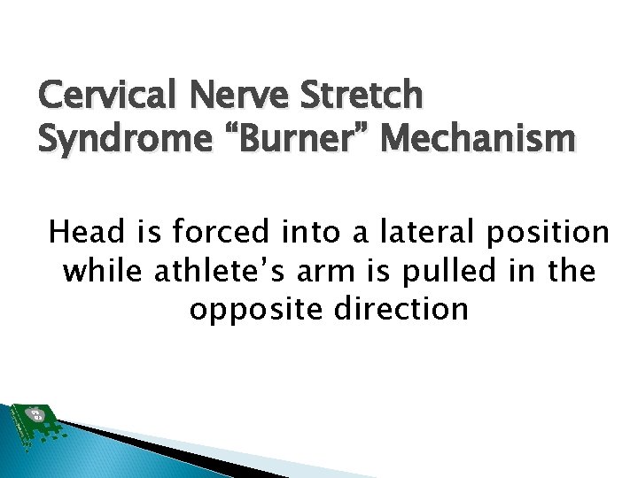 Cervical Nerve Stretch Syndrome “Burner” Mechanism Head is forced into a lateral position while