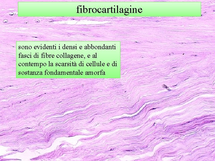 fibrocartilagine sono evidenti i densi e abbondanti fasci di fibre collagene, e al contempo