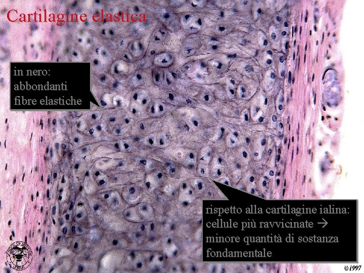 Cartilagine elastica in nero: abbondanti fibre elastiche rispetto alla cartilagine ialina: cellule più ravvicinate