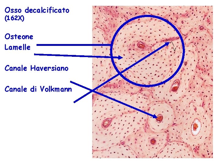 Osso decalcificato (162 X) Osteone Lamelle Canale Haversiano Canale di Volkmann 