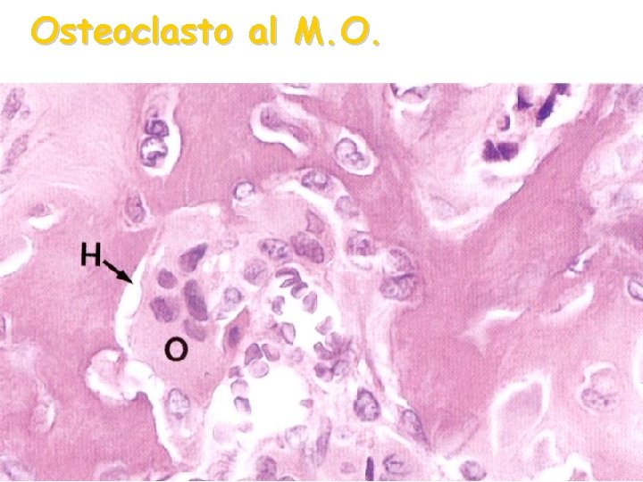 Osteoclasto al M. O. 