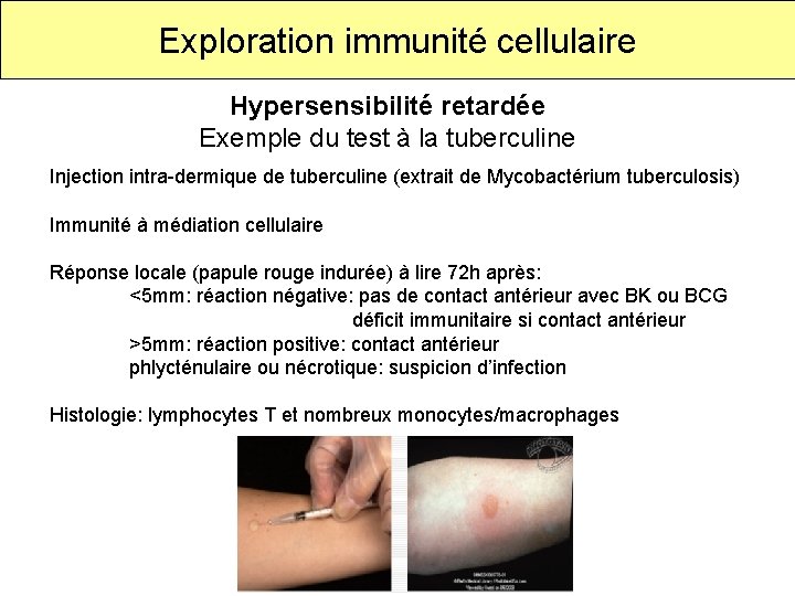 Exploration immunité cellulaire Hypersensibilité retardée Exemple du test à la tuberculine Injection intra-dermique de