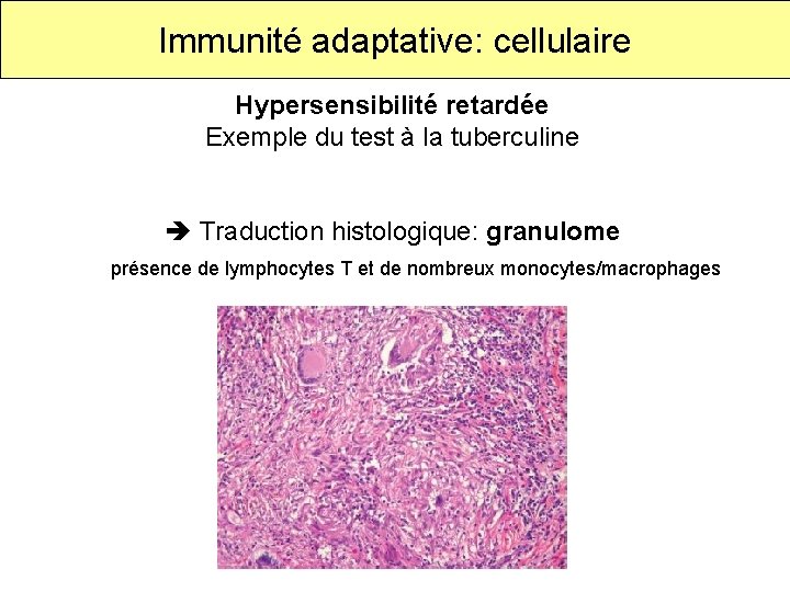 Immunité adaptative: cellulaire Hypersensibilité retardée Exemple du test à la tuberculine Traduction histologique: granulome
