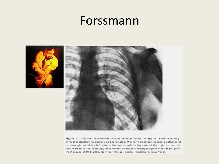 Forssmann 