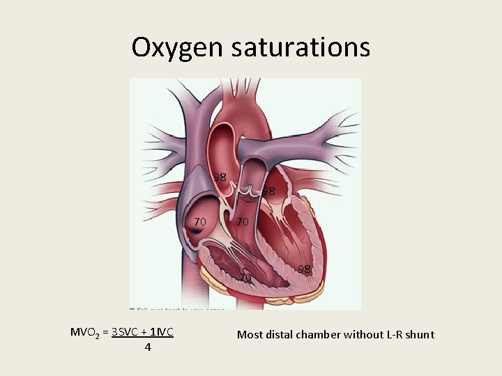 Oxygen saturations 98 70 70 MVO 2 = 3 SVC + 1 IVC 4