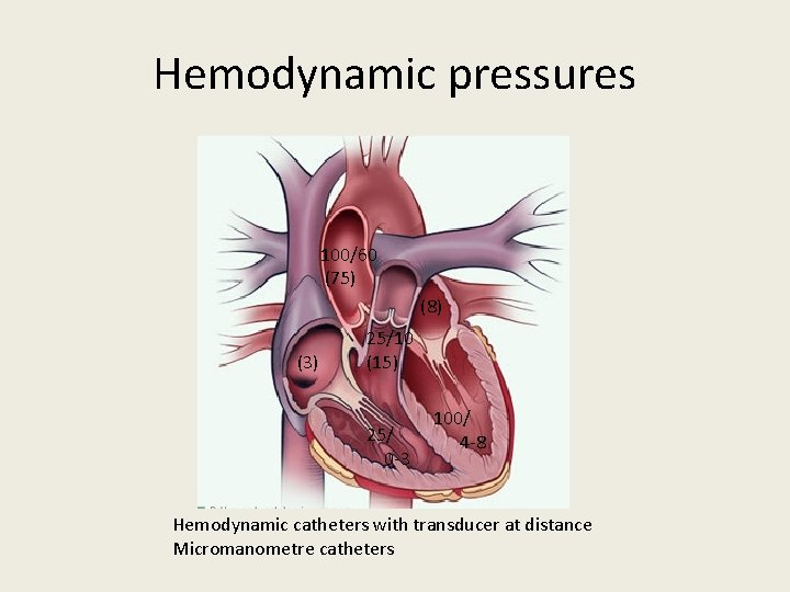 Hemodynamic pressures 100/60 (75) (8) (3) 25/10 (15) 25/ 0 -3 100/ 4 -8