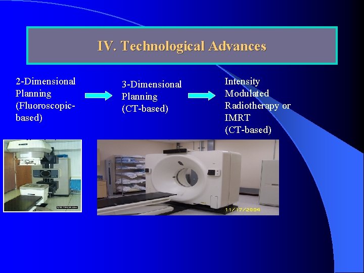 IV. Technological Advances 2 -Dimensional Planning (Fluoroscopicbased) 3 -Dimensional Planning (CT-based) Intensity Modulated Radiotherapy