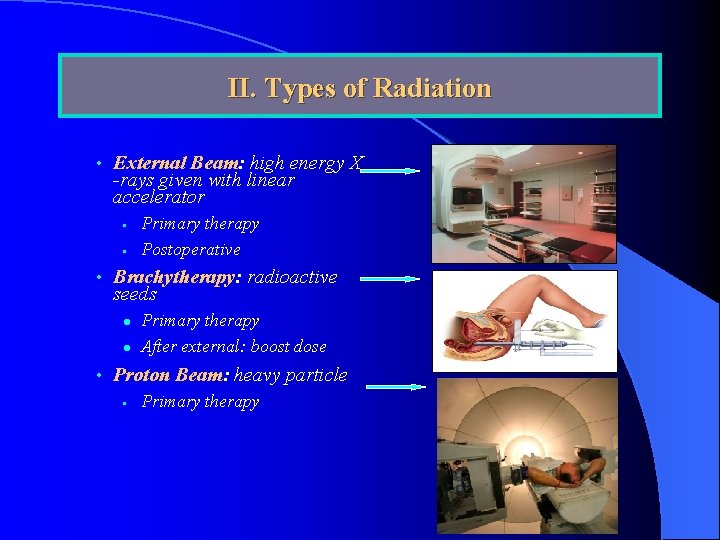 II. Types of Radiation • External Beam: high energy X -rays given with linear