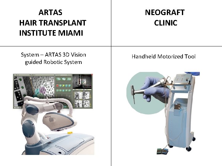  ARTAS HAIR TRANSPLANT INSTITUTE MIAMI System – ARTAS 3 D Vision guided Robotic