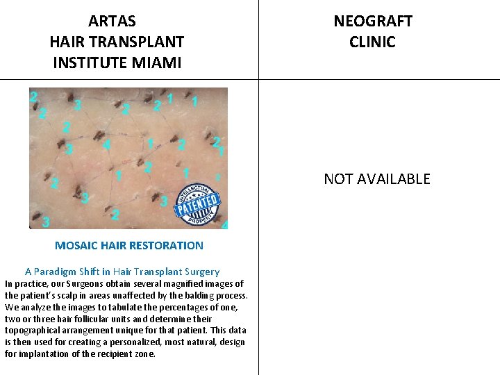  ARTAS HAIR TRANSPLANT INSTITUTE MIAMI NEOGRAFT CLINIC NOT AVAILABLE MOSAIC HAIR RESTORATION A
