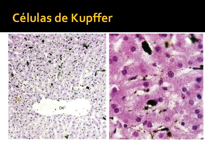 Células de Kupffer 