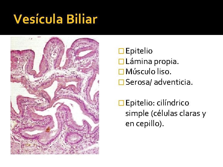 Vesícula Biliar � Epitelio � Lámina propia. � Músculo liso. � Serosa/ adventicia. �