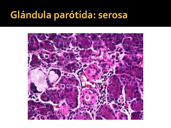 Glándula parótida: serosa 