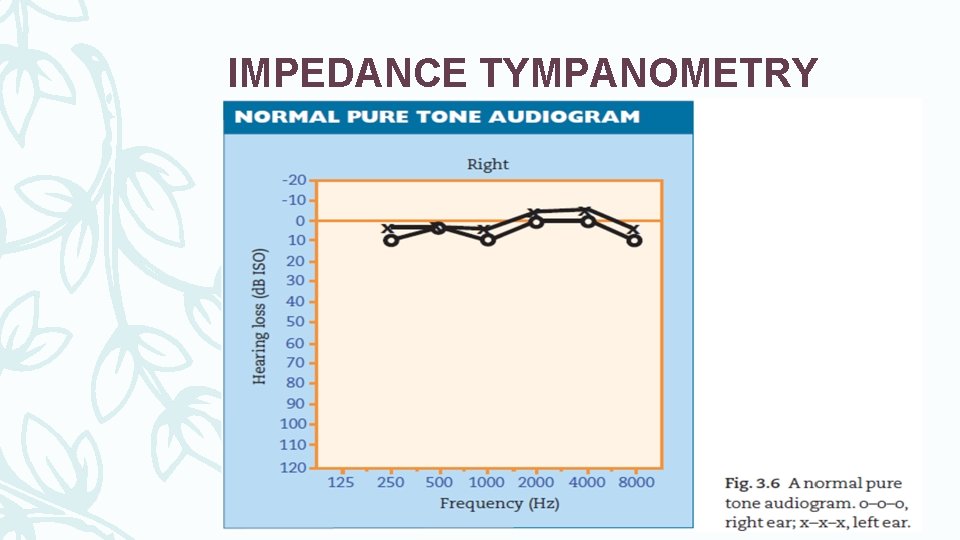 IMPEDANCE TYMPANOMETRY 