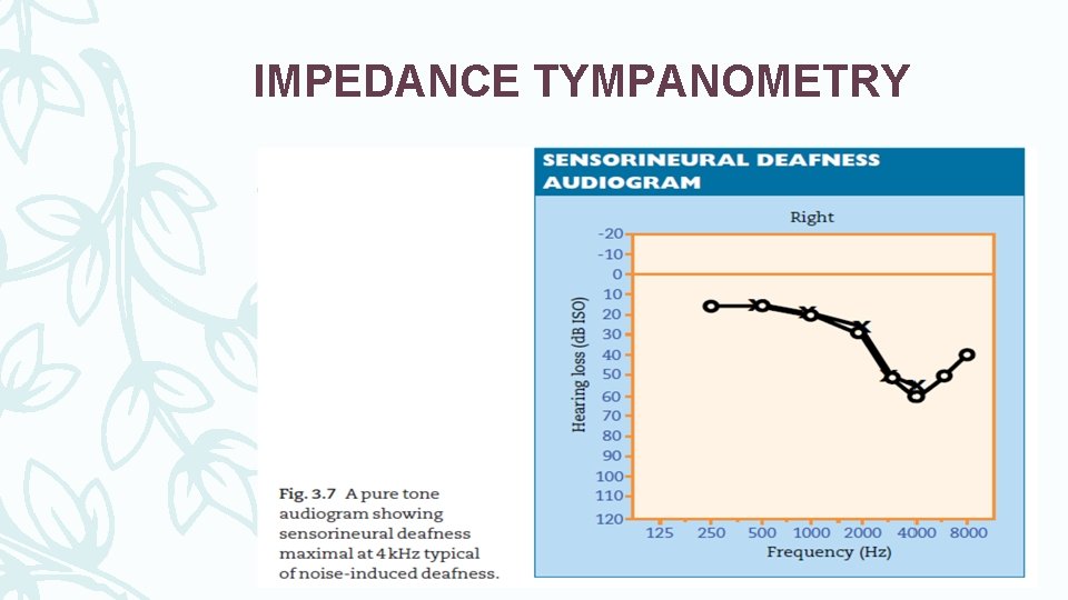 IMPEDANCE TYMPANOMETRY 