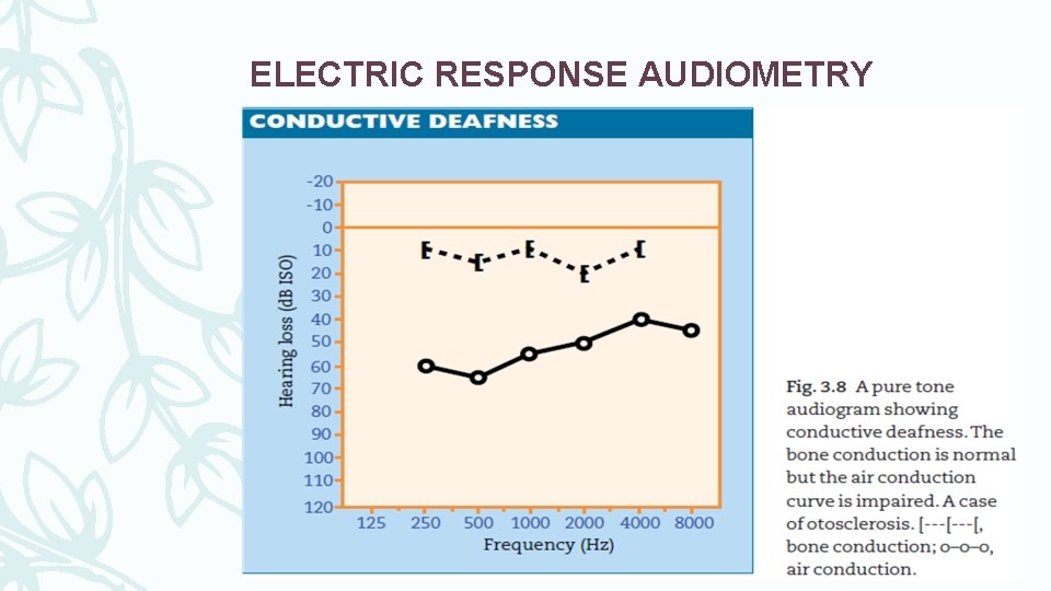 ELECTRIC RESPONSE AUDIOMETRY 