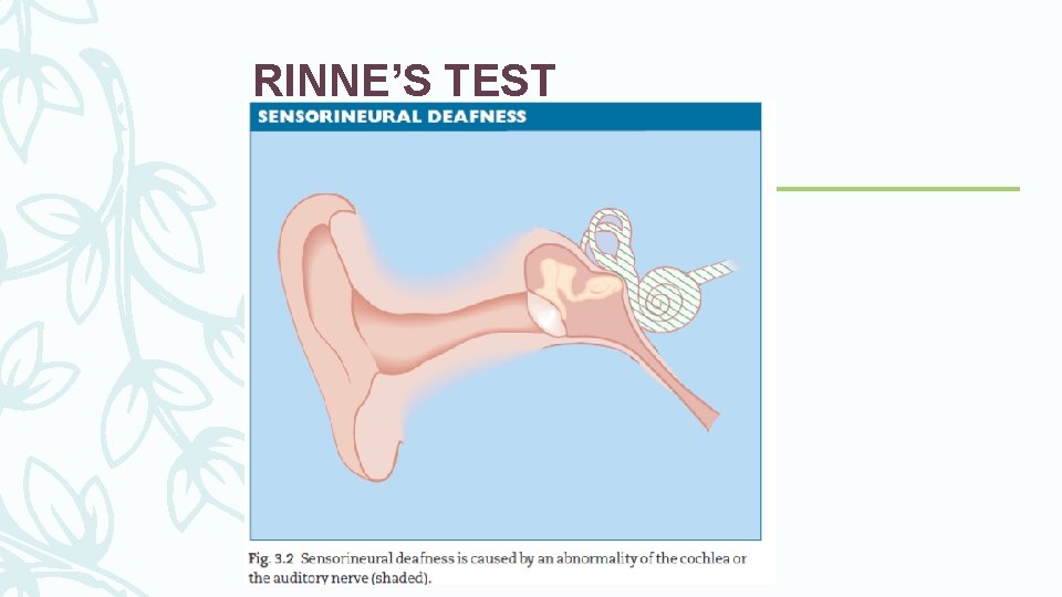 RINNE’S TEST 