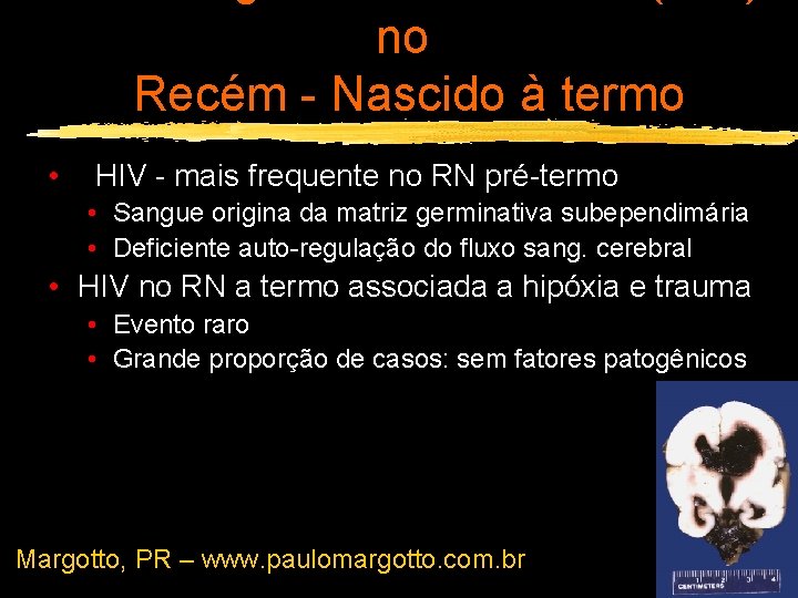 no Recém - Nascido à termo • HIV - mais frequente no RN pré-termo