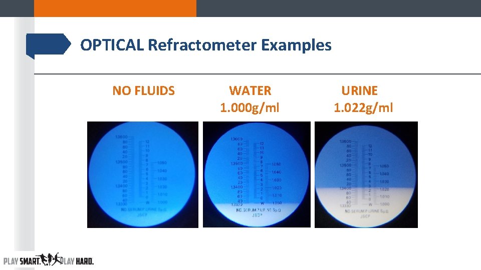 OPTICAL Refractometer Examples NO FLUIDS WATER 1. 000 g/ml URINE 1. 022 g/ml OPTICAL Refractometer Examples NO FLUIDS WATER 1. 000 g/ml URINE 1. 022 g/ml