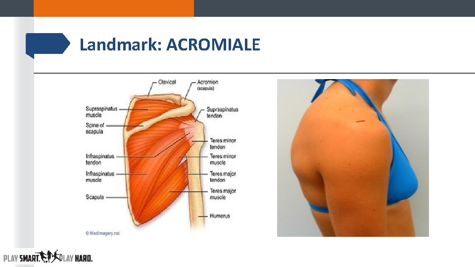 Landmark: ACROMIALE Landmark: ACROMIALE