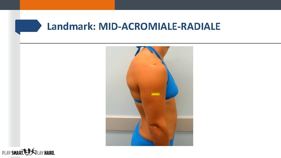 Landmark: MID-ACROMIALE-RADIALE Landmark: MID-ACROMIALE-RADIALE