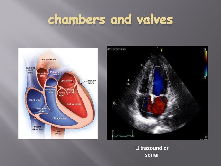 chambers and valves Ultrasound or sonar 