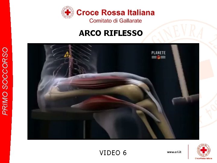 PRIMO SOCCORSO ARCO RIFLESSO VIDEO 6 