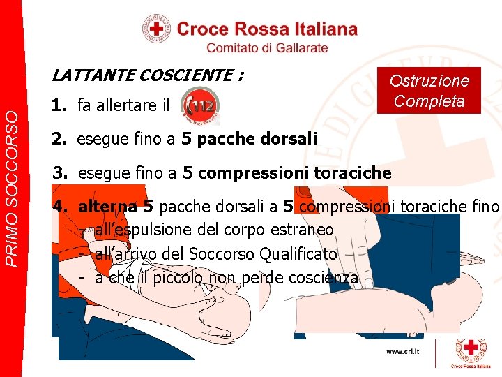 PRIMO SOCCORSO LATTANTE COSCIENTE : 1. fa allertare il Ostruzione Completa 2. esegue fino