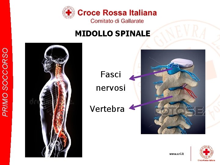 PRIMO SOCCORSO MIDOLLO SPINALE Fasci nervosi Vertebra 