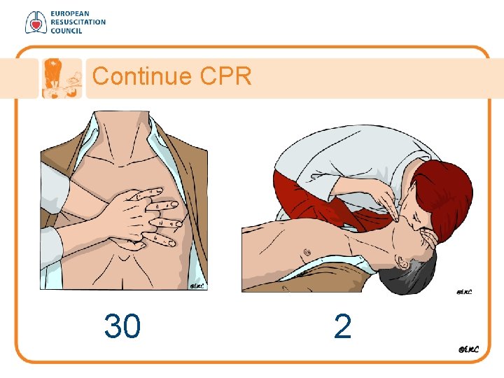 Continue CPR 30 2 