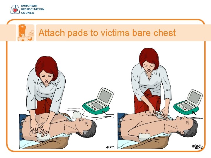 Attach pads to victims bare chest 