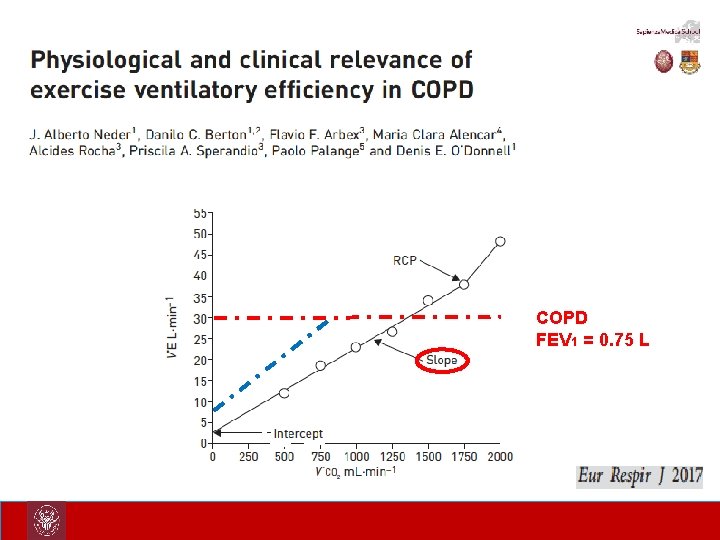COPD FEV 1 = 0. 75 L 
