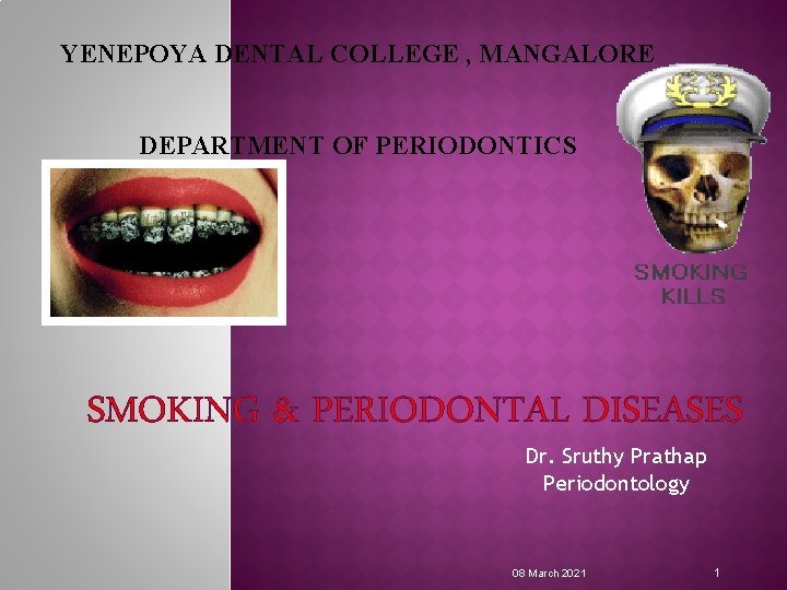 YENEPOYA DENTAL COLLEGE , MANGALORE DEPARTMENT OF PERIODONTICS SMOKING & PERIODONTAL DISEASES Dr. Sruthy