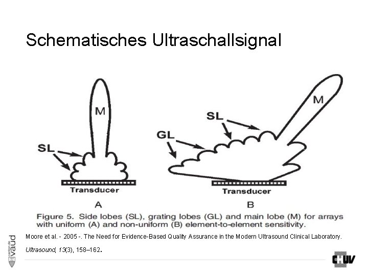 Schematisches Ultraschallsignal Moore et al. - 2005 -. The Need for Evidence-Based Quality Assurance Schematisches Ultraschallsignal Moore et al. - 2005 -. The Need for Evidence-Based Quality Assurance