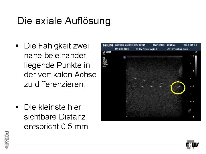 Die axiale Auflösung § Die Fähigkeit zwei nahe beieinander liegende Punkte in der vertikalen Die axiale Auflösung § Die Fähigkeit zwei nahe beieinander liegende Punkte in der vertikalen