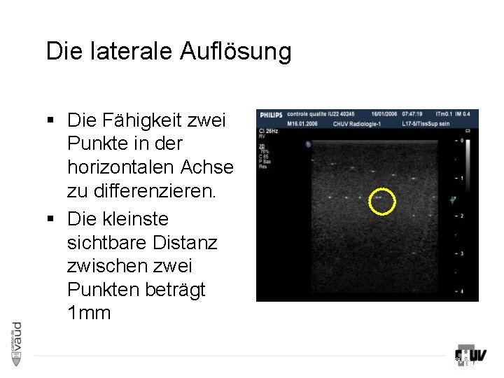 Die laterale Auflösung § Die Fähigkeit zwei Punkte in der horizontalen Achse zu differenzieren. Die laterale Auflösung § Die Fähigkeit zwei Punkte in der horizontalen Achse zu differenzieren.