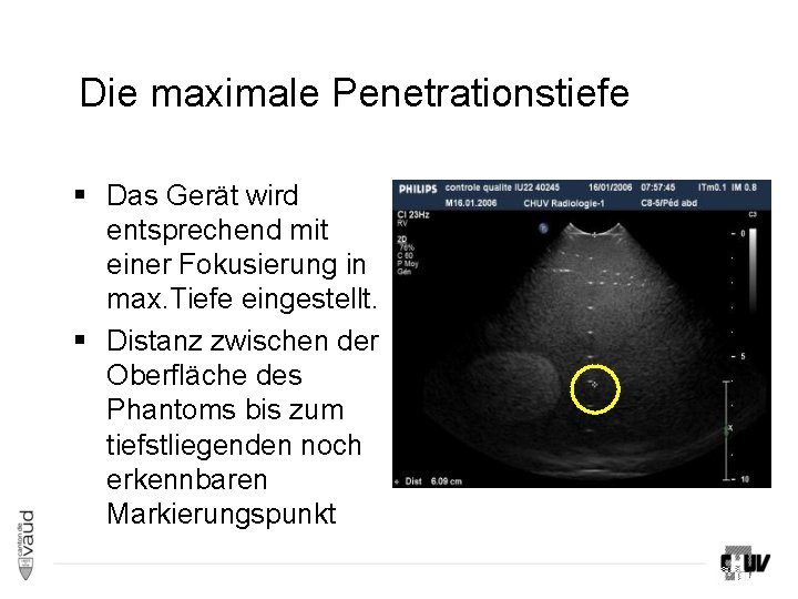 Die maximale Penetrationstiefe § Das Gerät wird entsprechend mit einer Fokusierung in max. Tiefe Die maximale Penetrationstiefe § Das Gerät wird entsprechend mit einer Fokusierung in max. Tiefe