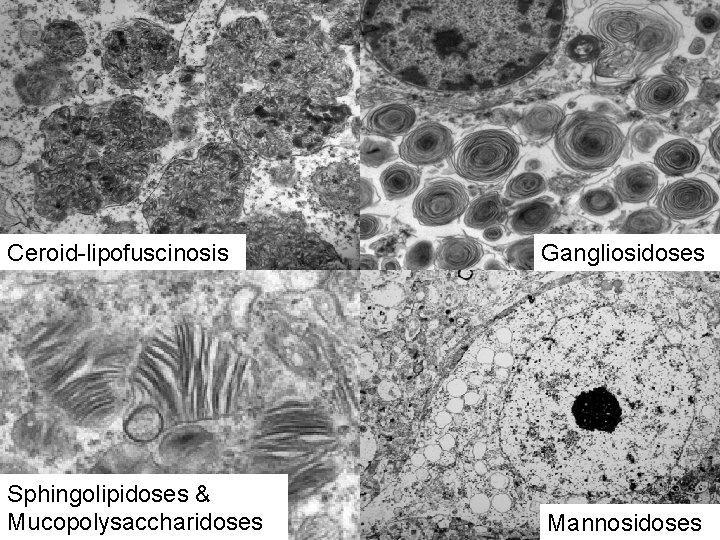 Ceroid-lipofuscinosis Gangliosidoses Sphingolipidoses & Mucopolysaccharidoses Mannosidoses 