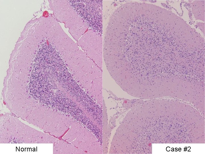 Normal Case #2 