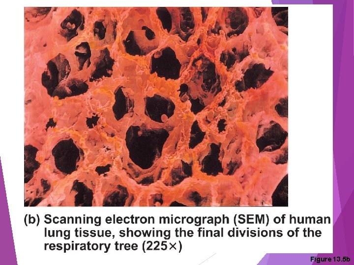 Figure 13. 5 b 