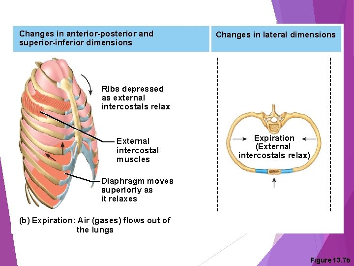 Changes in anterior-posterior and superior-inferior dimensions Changes in lateral dimensions Ribs depressed as external