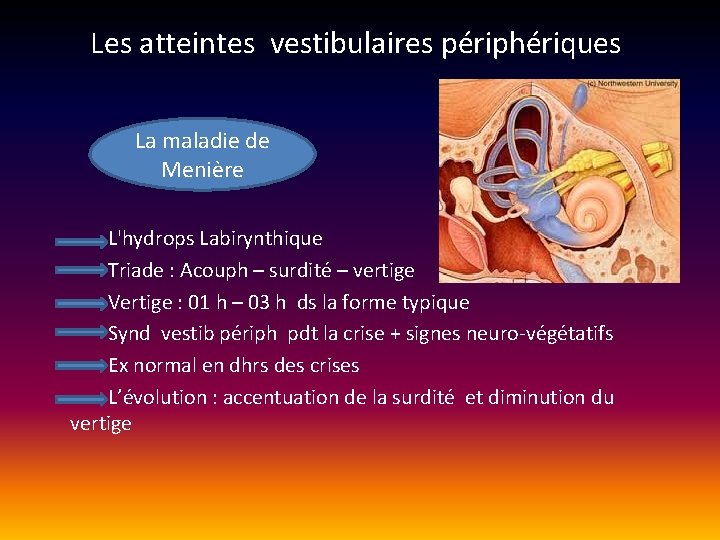 Les atteintes vestibulaires périphériques La maladie de Menière L'hydrops Labirynthique Triade : Acouph – Les atteintes vestibulaires périphériques La maladie de Menière L'hydrops Labirynthique Triade : Acouph –