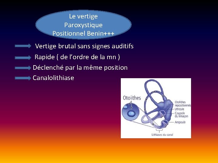 Le vertige Paroxystique Positionnel Benin+++ Vertige brutal sans signes auditifs Rapide ( de l’ordre Le vertige Paroxystique Positionnel Benin+++ Vertige brutal sans signes auditifs Rapide ( de l’ordre