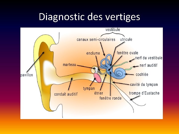 Diagnostic des vertiges Diagnostic des vertiges