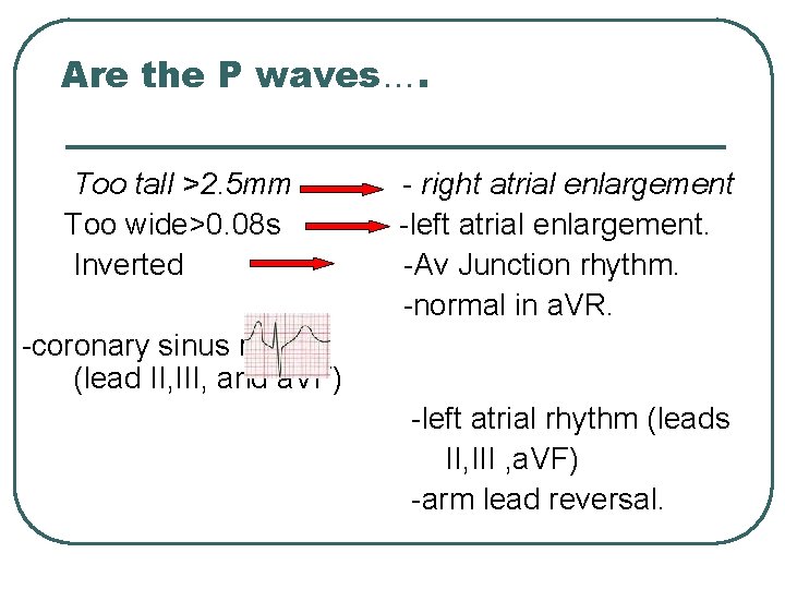 Are the P waves…. Too tall >2. 5 mm Too wide>0. 08 s Inverted