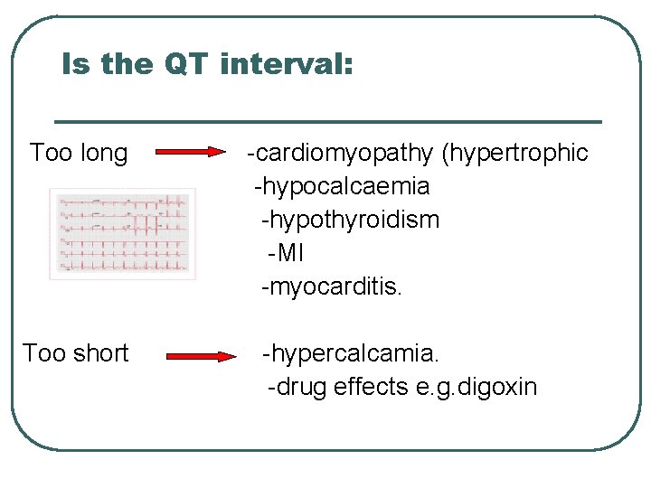 Is the QT interval: Too long Too short -cardiomyopathy (hypertrophic -hypocalcaemia -hypothyroidism -MI -myocarditis.