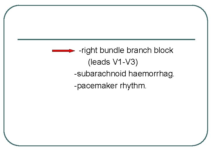 -right bundle branch block (leads V 1 -V 3) -subarachnoid haemorrhag. -pacemaker rhythm. 