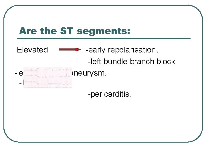 Are the ST segments: -early repolarisation. -left bundle branch block. -left ventricular aneurysm. -MI