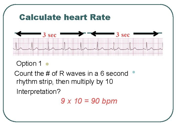 Calculate heart Rate 3 sec Option 1 l Count the # of R waves
