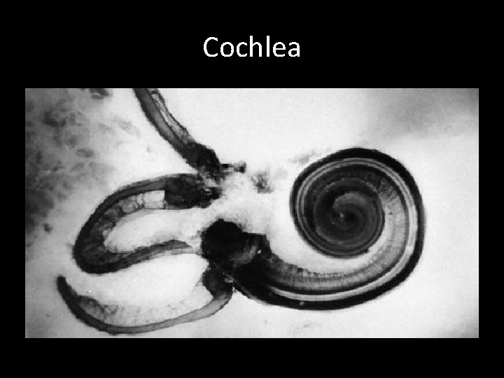 Cochlea 